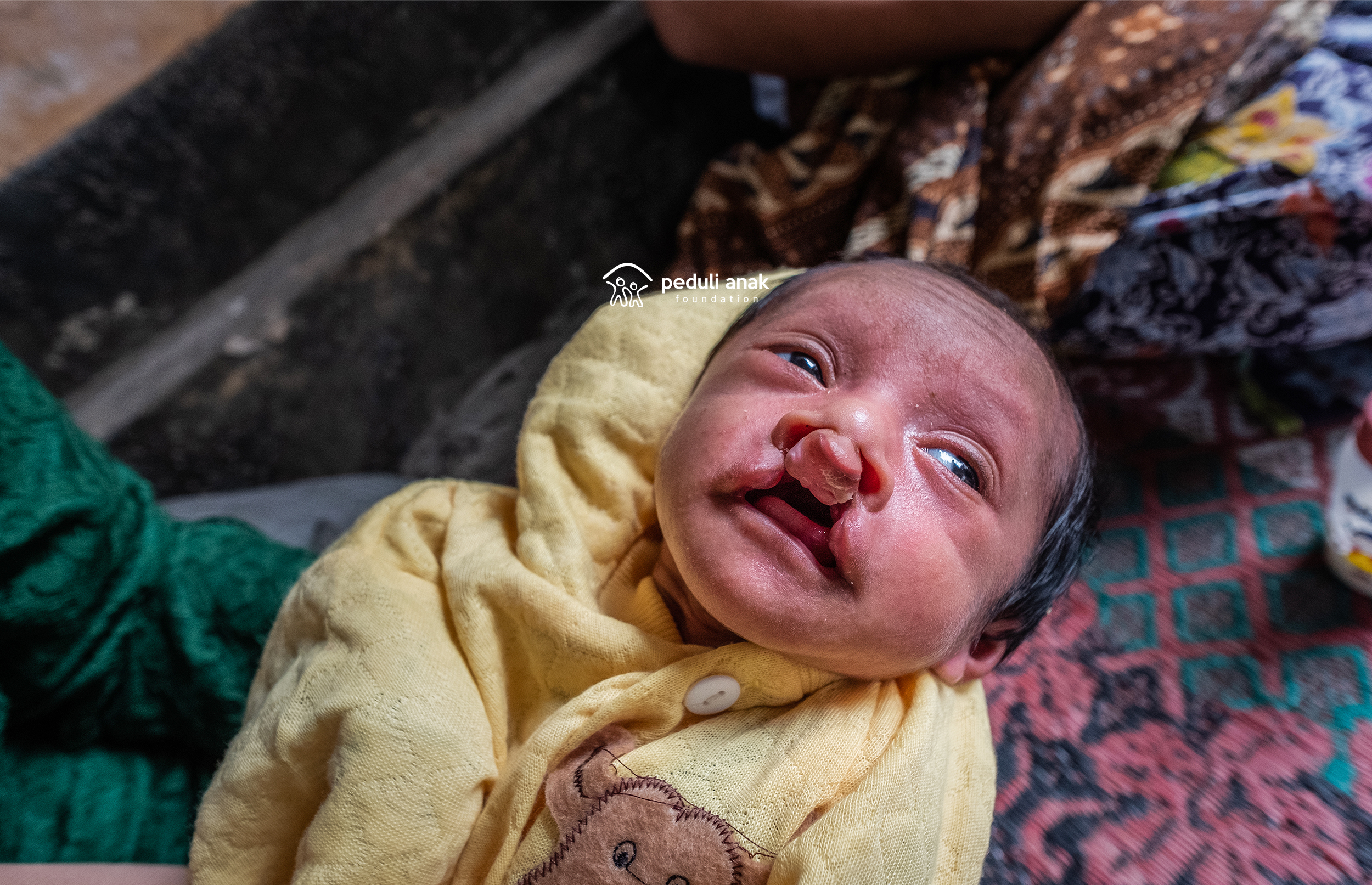 Bantu Klinik Gratis untuk Anak Yatim dan Anak Terlantar